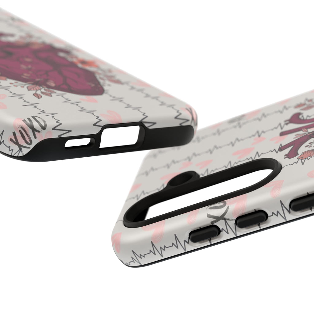 Anatomical Heart Phone Case