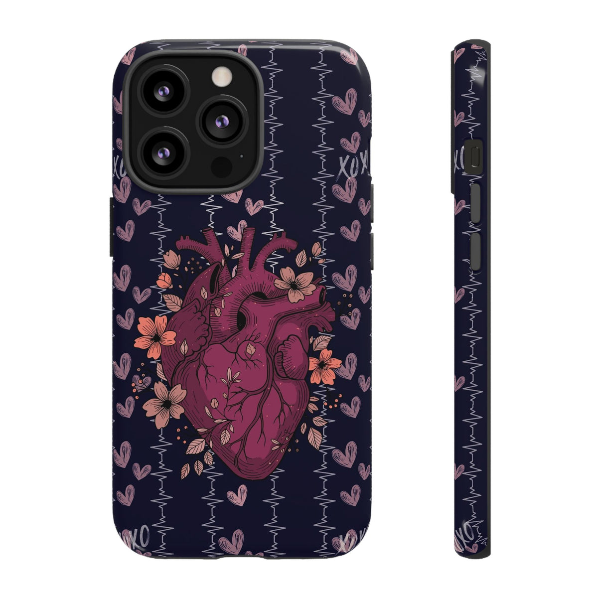 Dark Anatomical Heart Phone Case