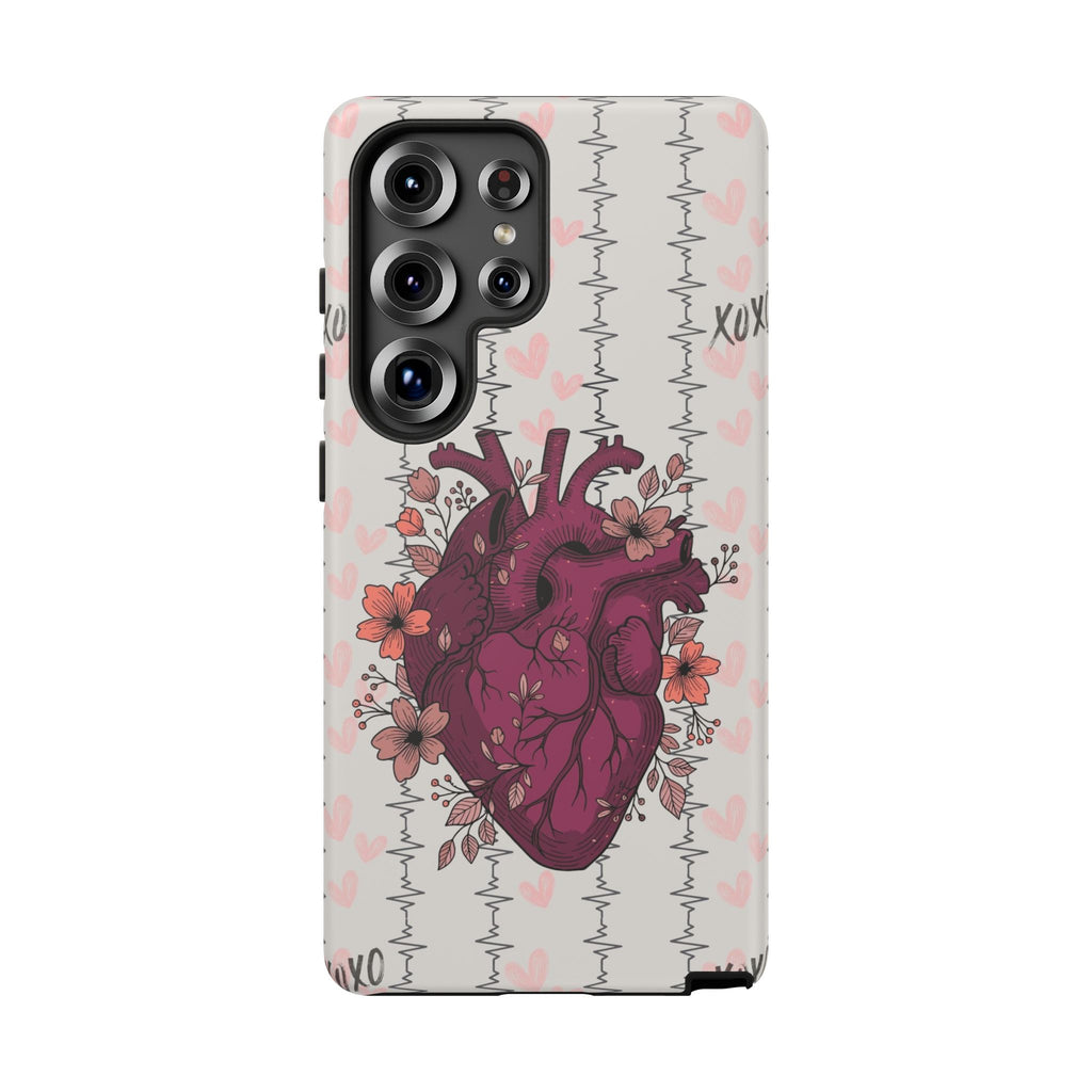 Anatomical Heart Phone Case