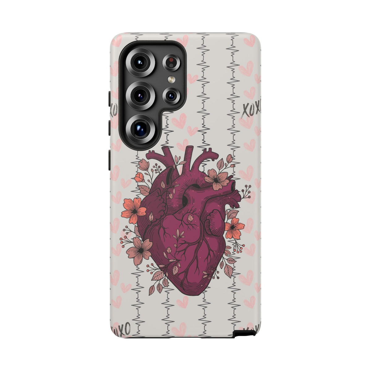 Anatomical Heart Phone Case