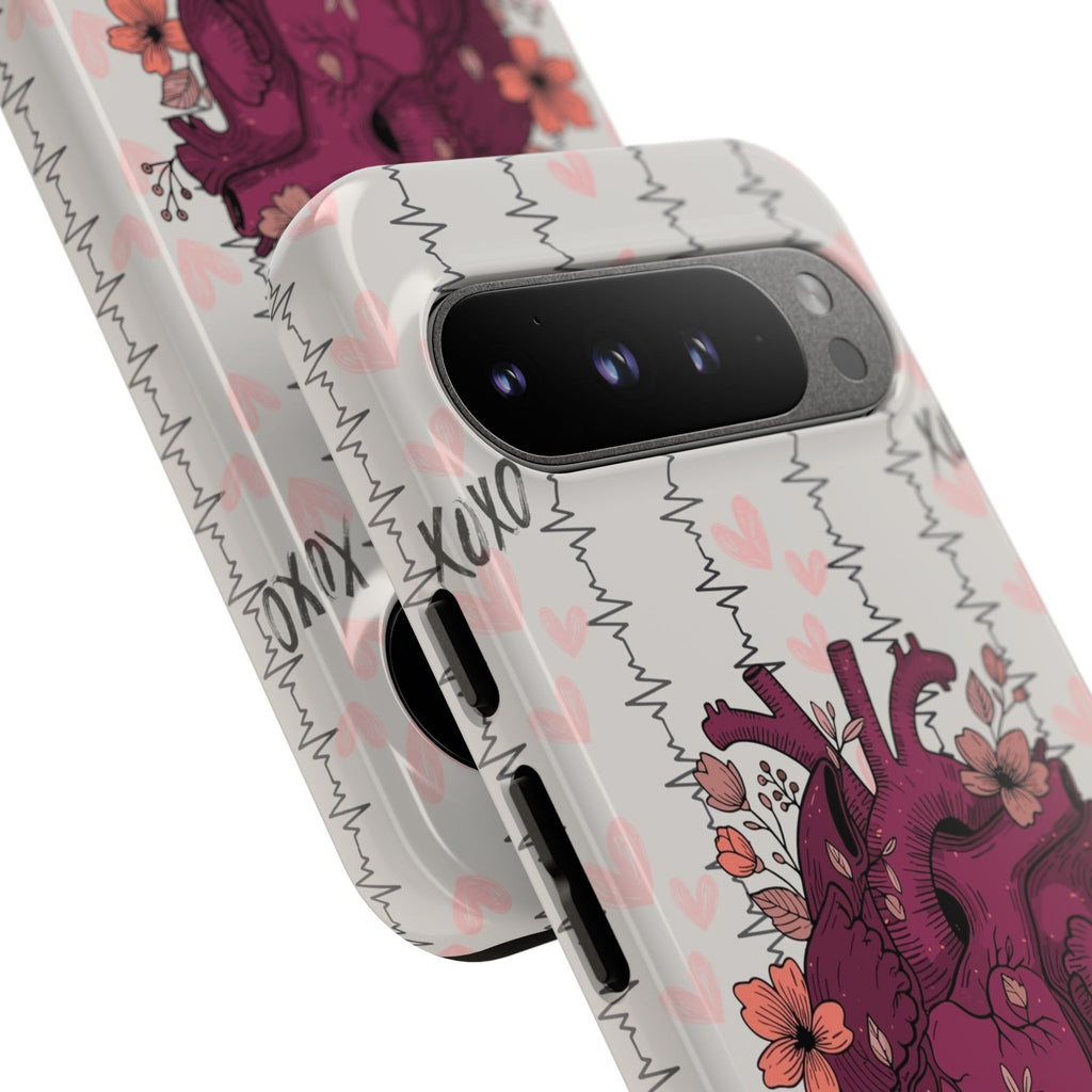 Anatomical Heart Phone Case