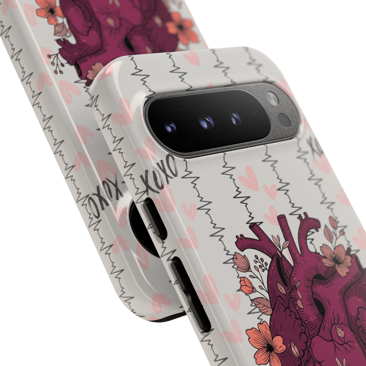 Anatomical Heart Phone Case