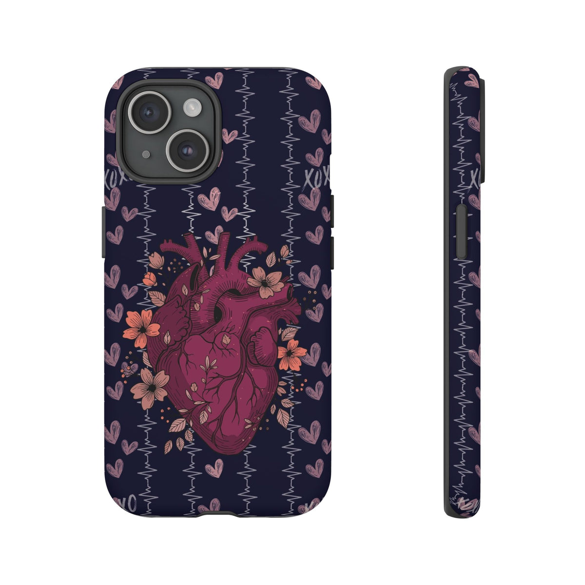 Dark Anatomical Heart Phone Case