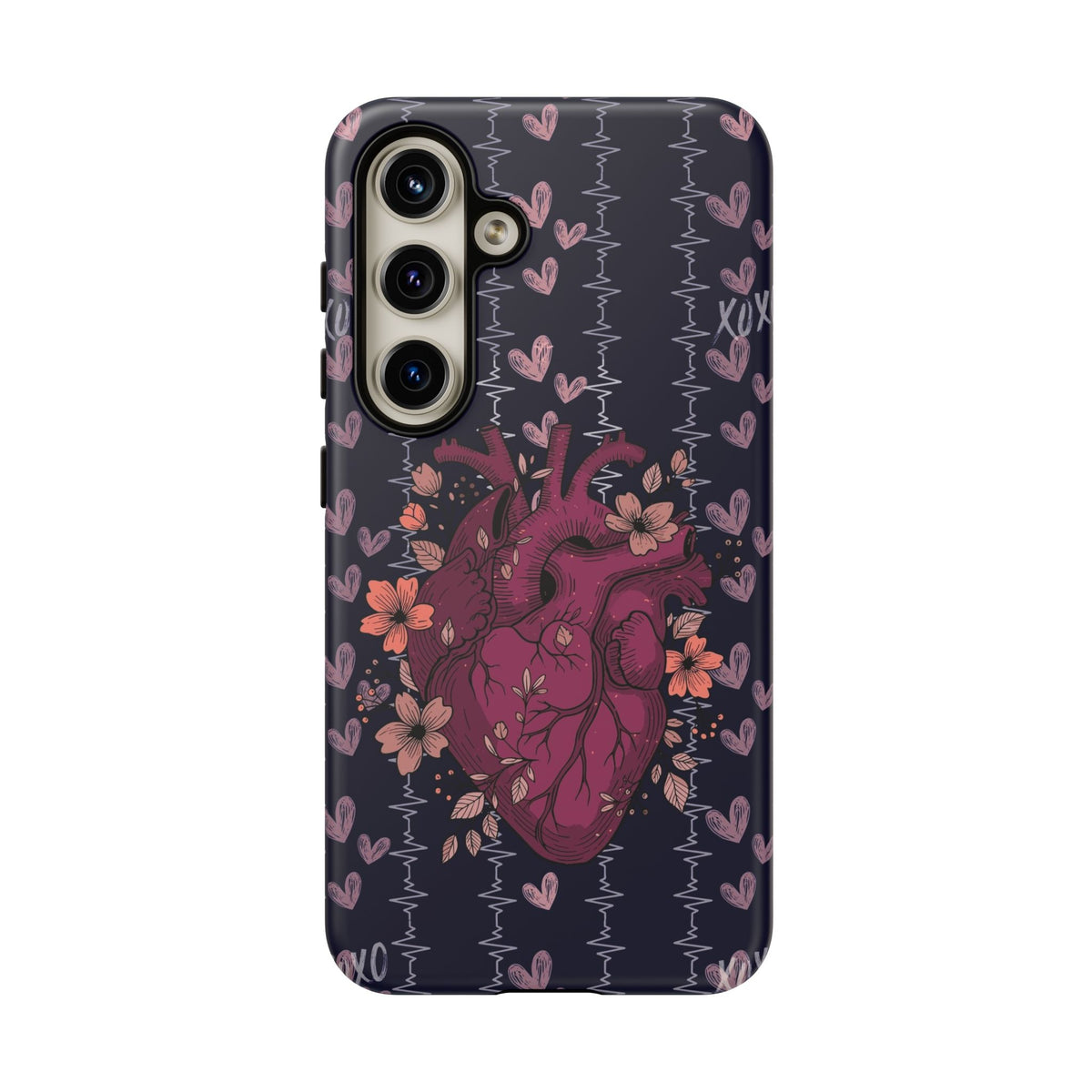Dark Anatomical Heart Phone Case
