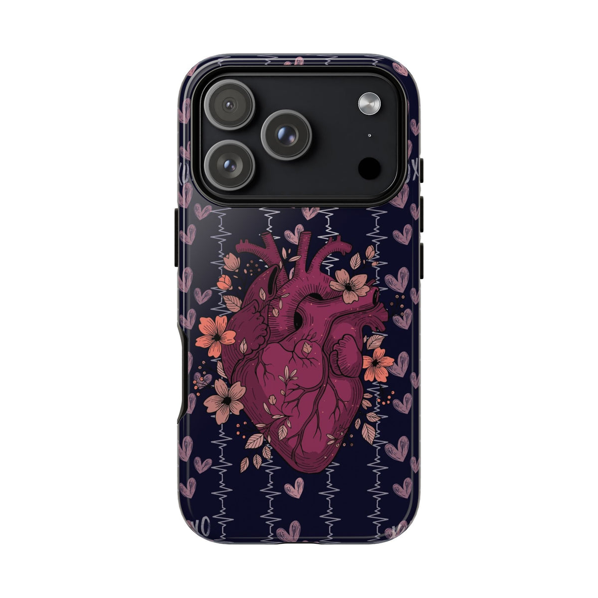 Dark Anatomical Heart Phone Case