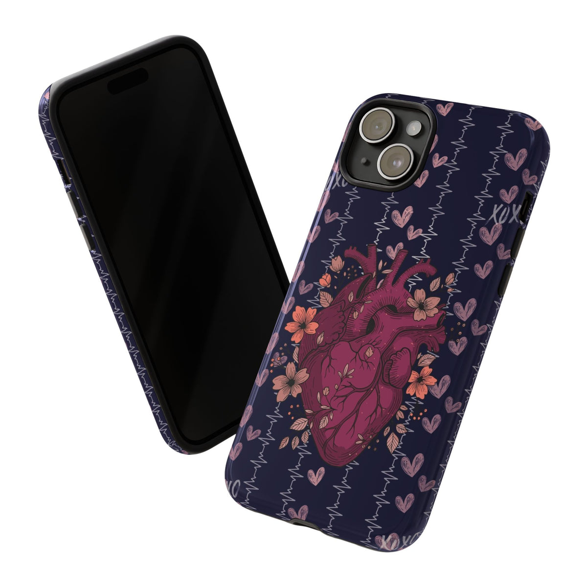 Dark Anatomical Heart Phone Case