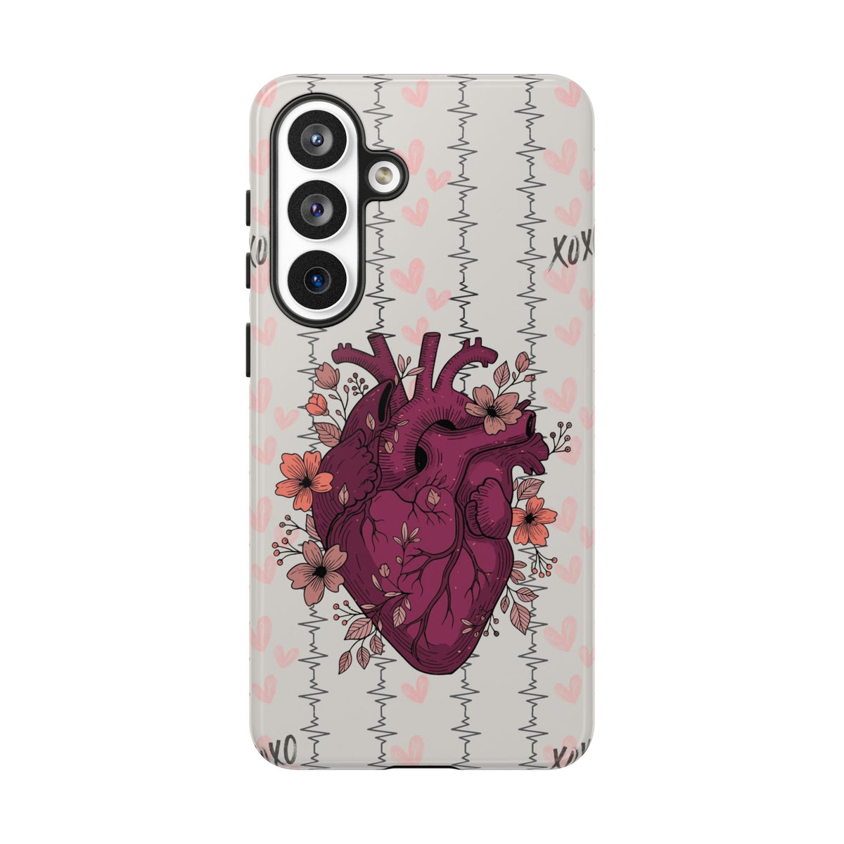 Anatomical Heart Phone Case