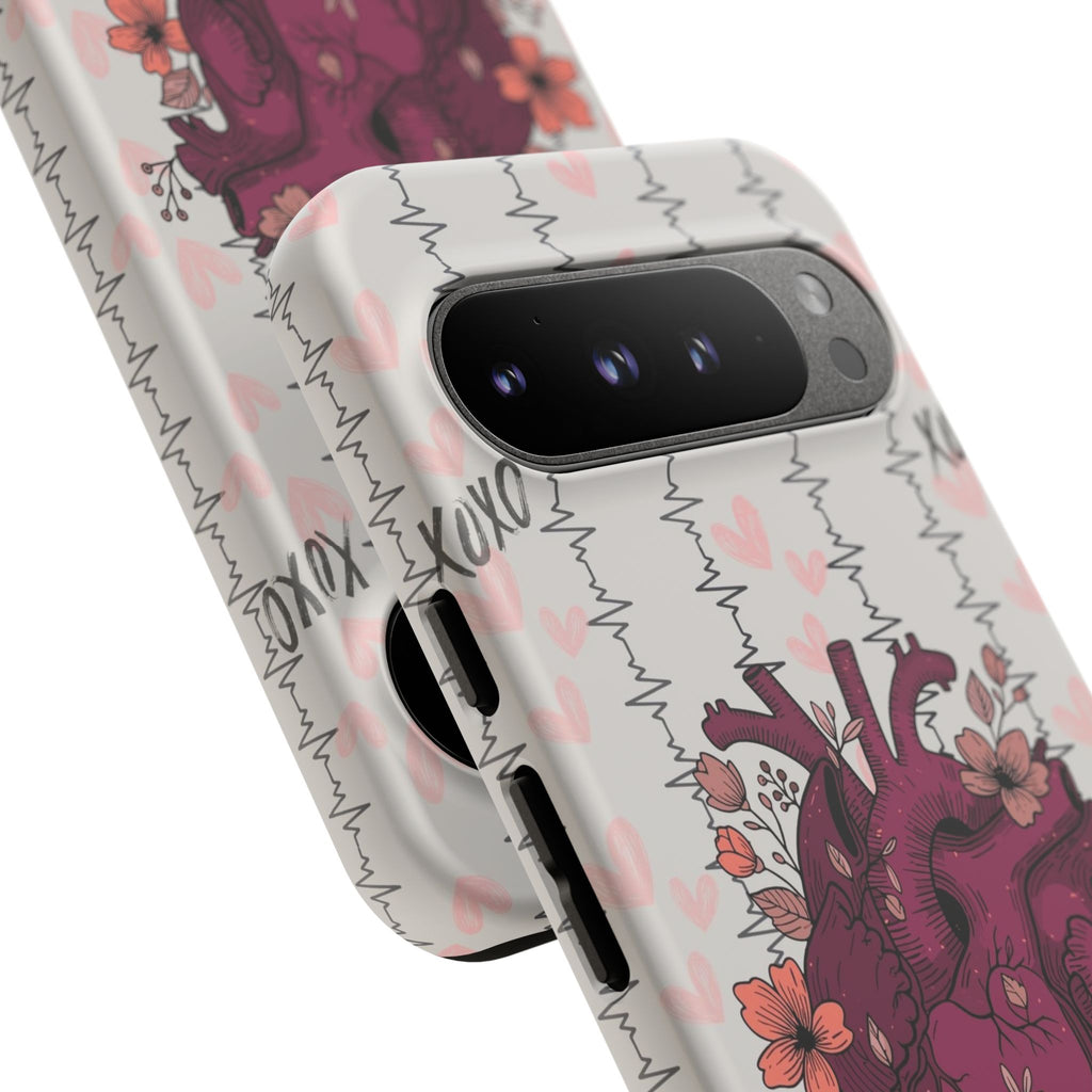 Anatomical Heart Phone Case