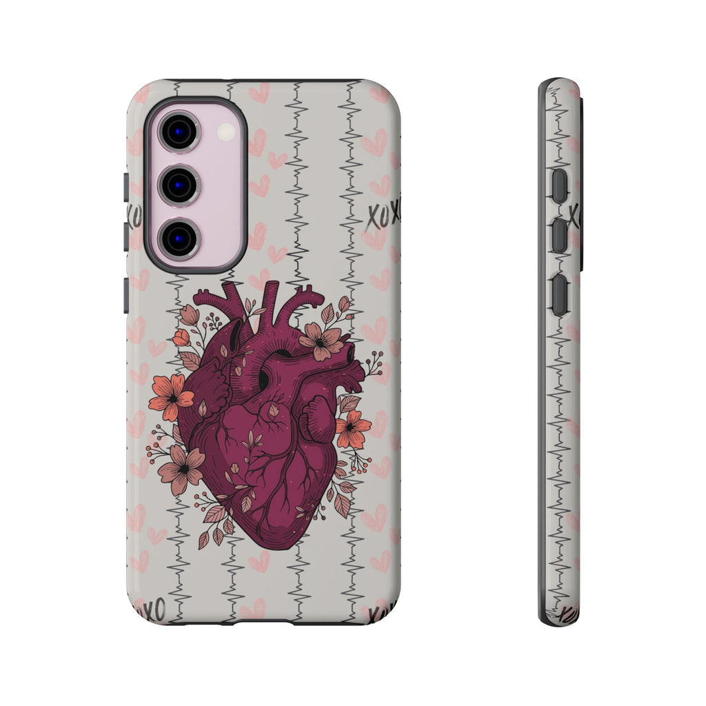 Anatomical Heart Phone Case