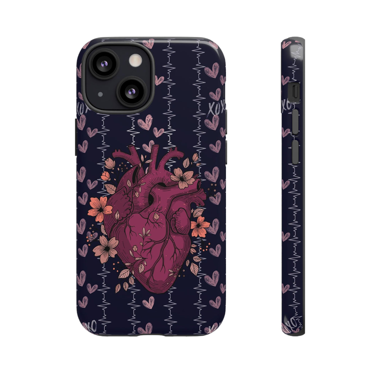 Dark Anatomical Heart Phone Case