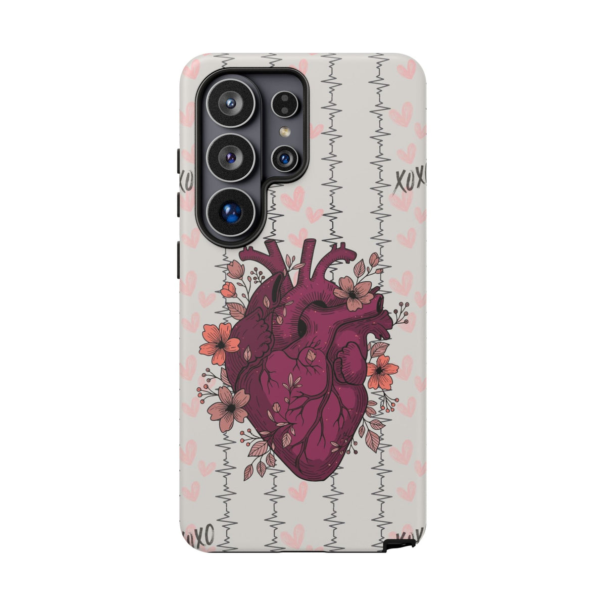 Anatomical Heart Phone Case