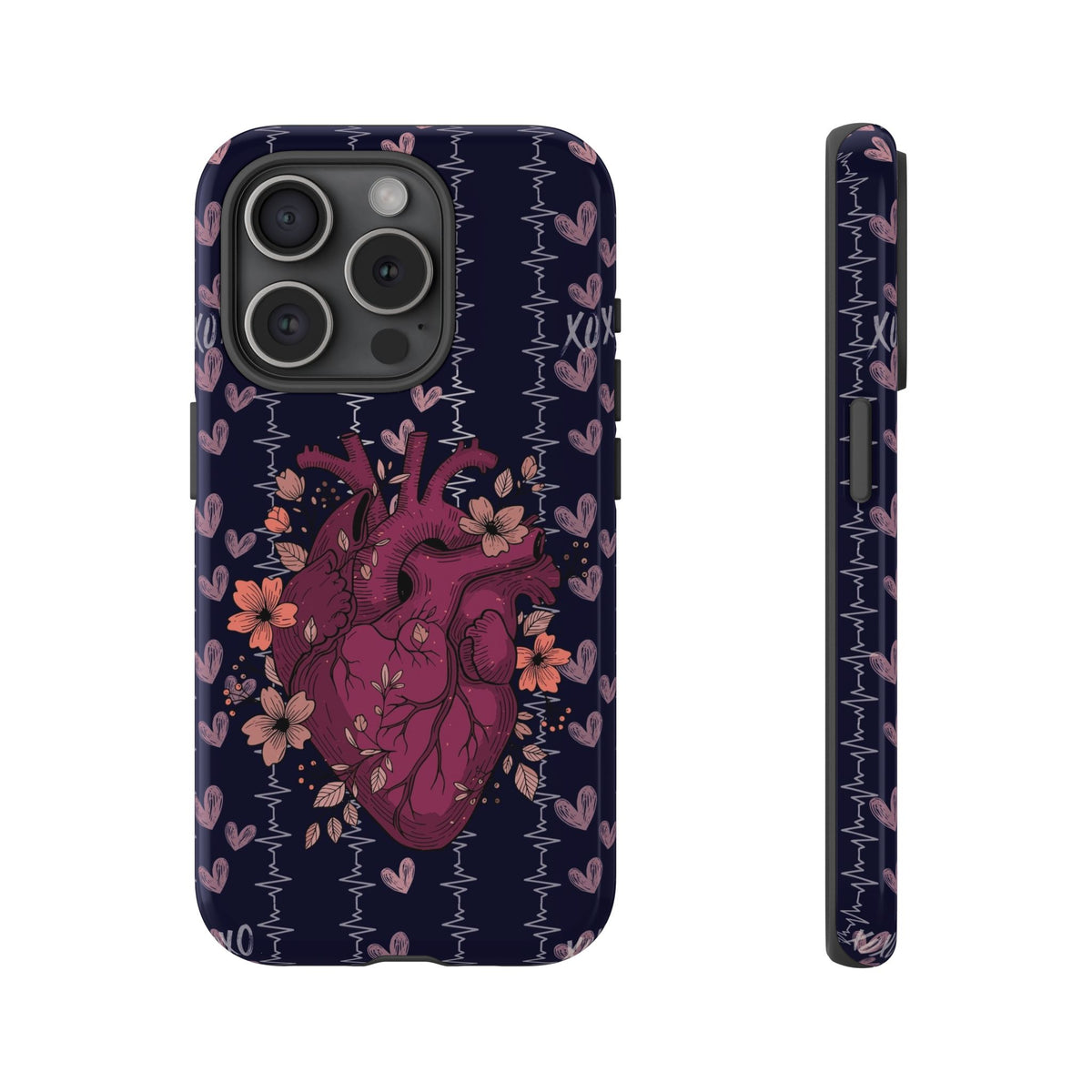 Dark Anatomical Heart Phone Case