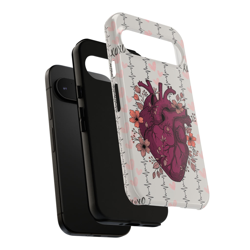 Anatomical Heart Phone Case