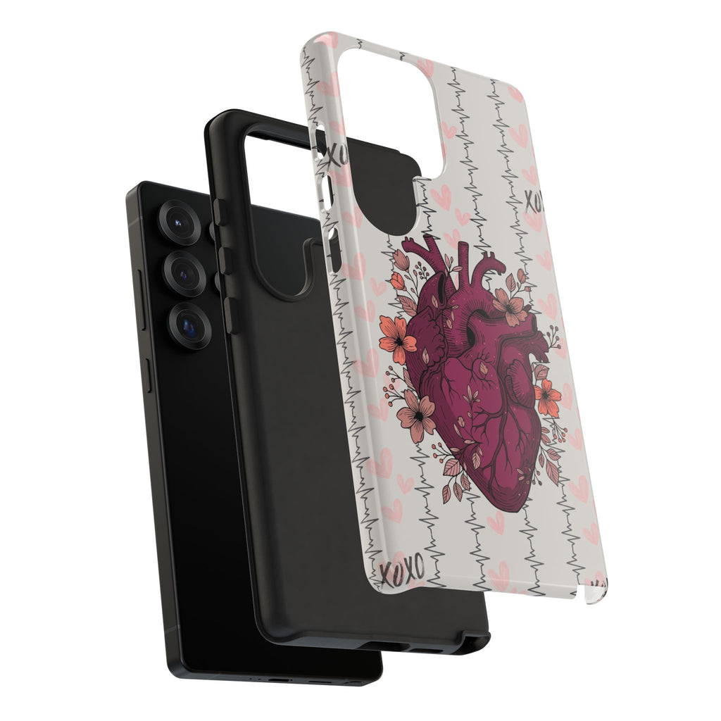 Anatomical Heart Phone Case