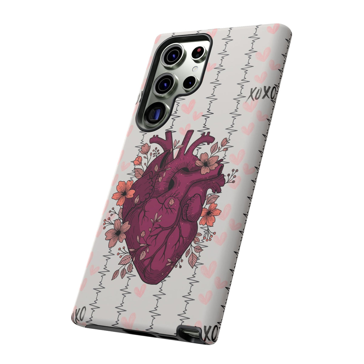 Anatomical Heart Phone Case