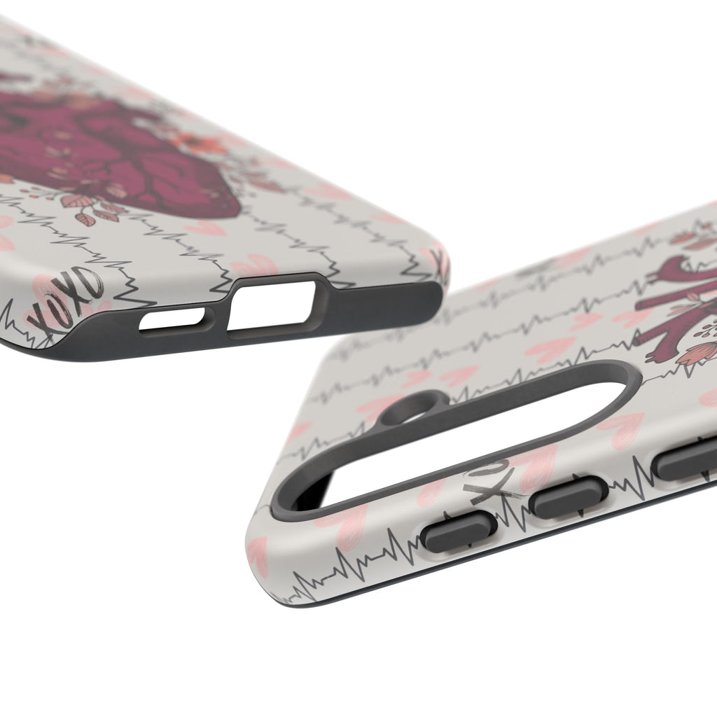 Anatomical Heart Phone Case