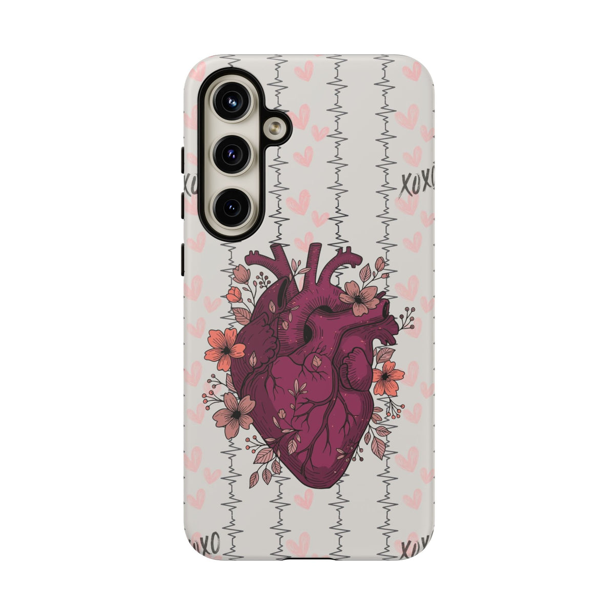 Anatomical Heart Phone Case