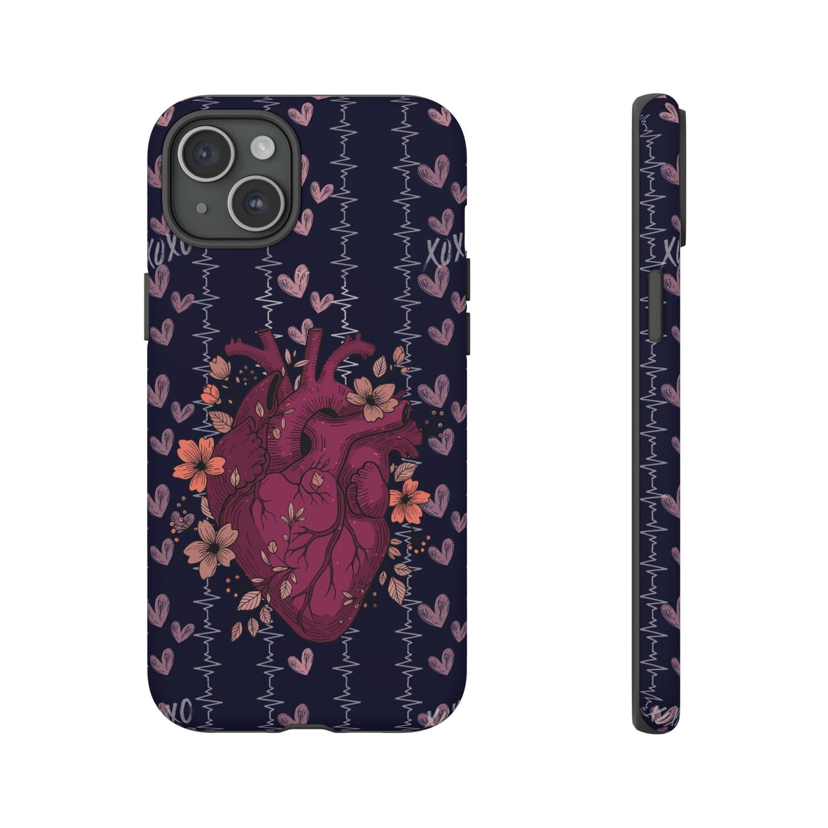 Dark Anatomical Heart Phone Case