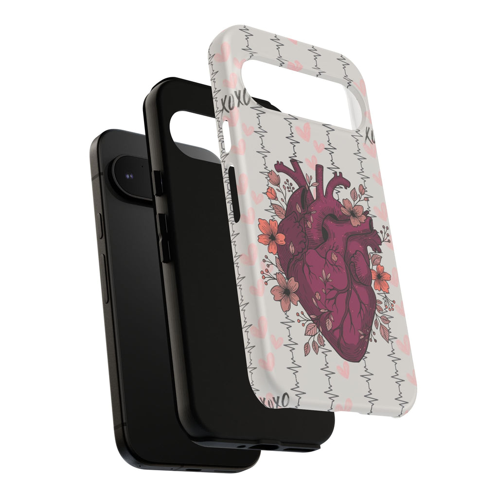 Anatomical Heart Phone Case