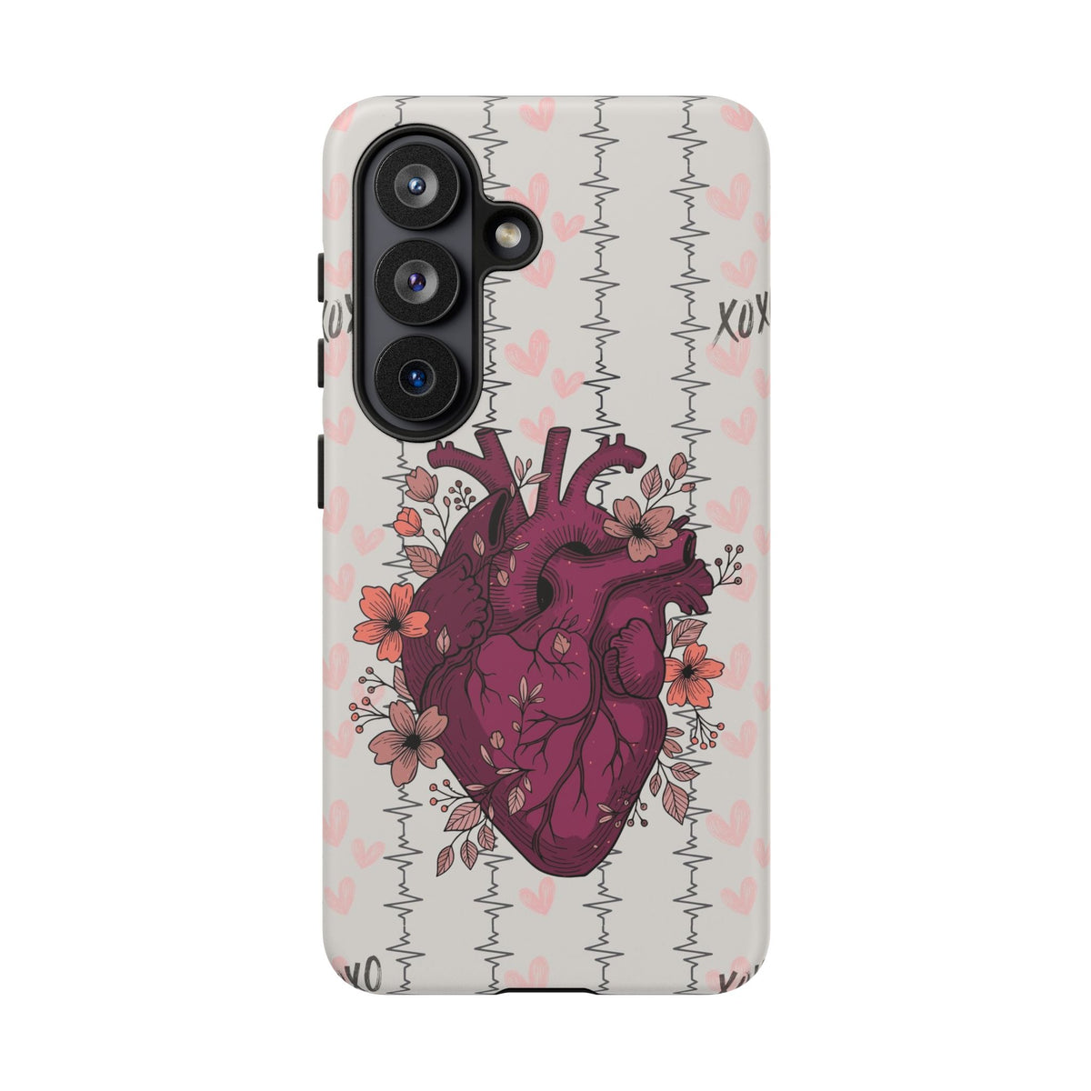 Anatomical Heart Phone Case