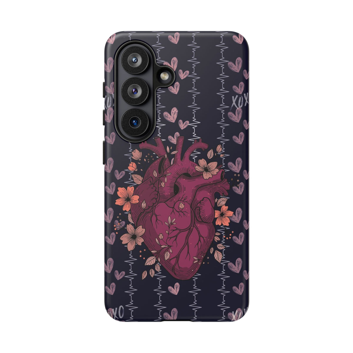 Dark Anatomical Heart Phone Case