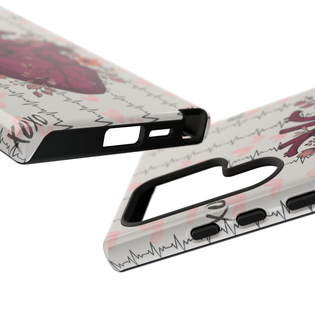 Anatomical Heart Phone Case