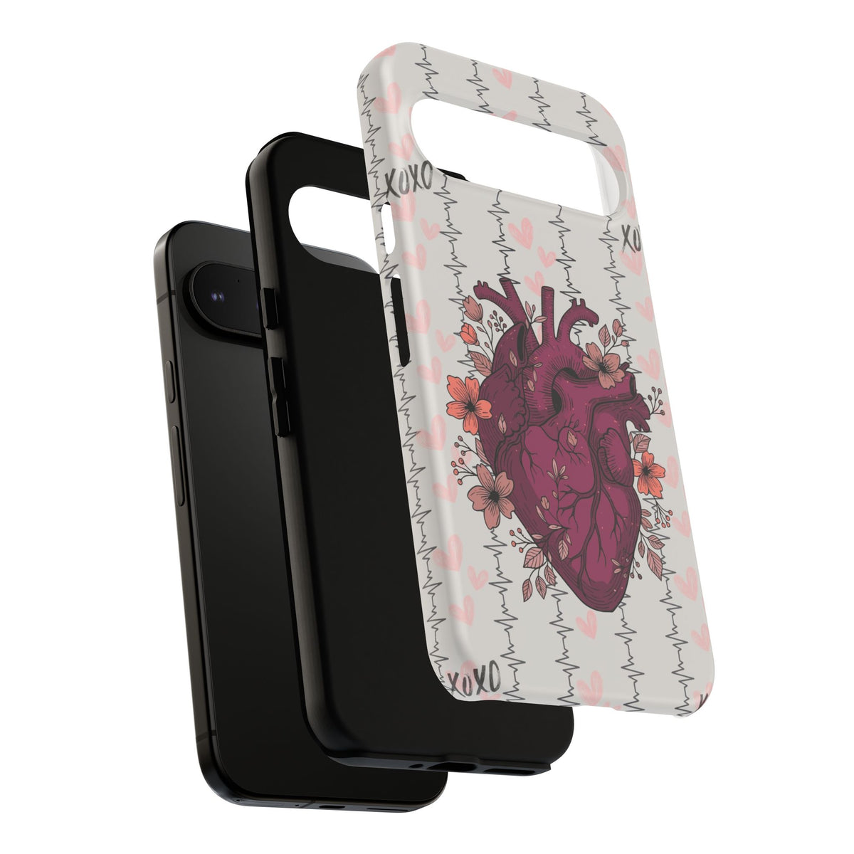Anatomical Heart Phone Case
