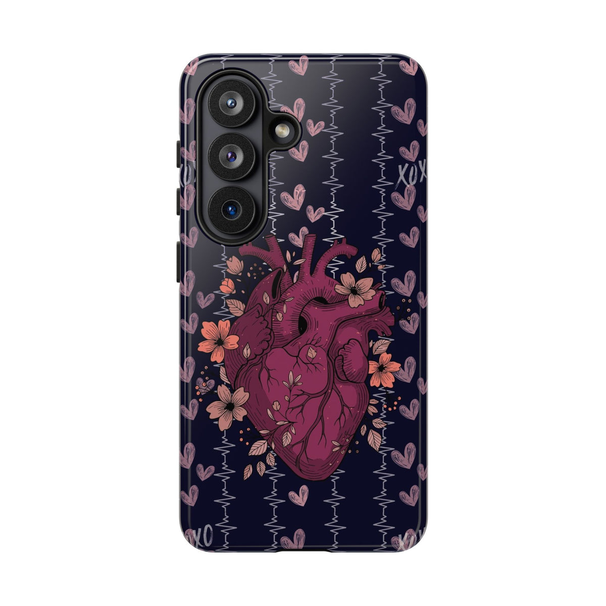 Dark Anatomical Heart Phone Case