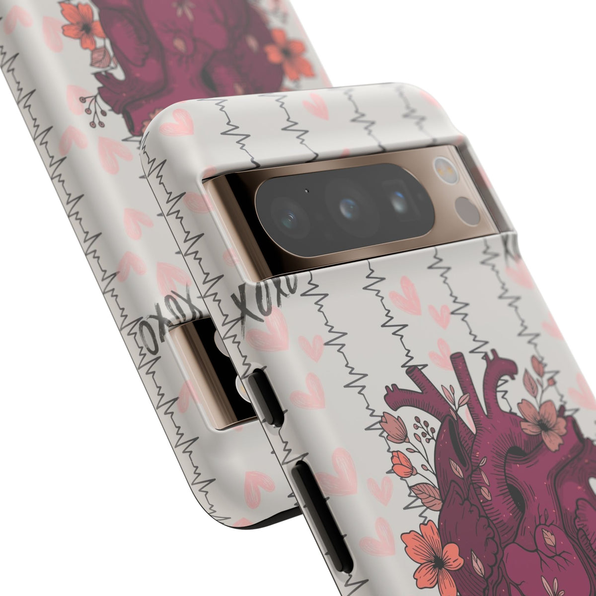 Anatomical Heart Phone Case
