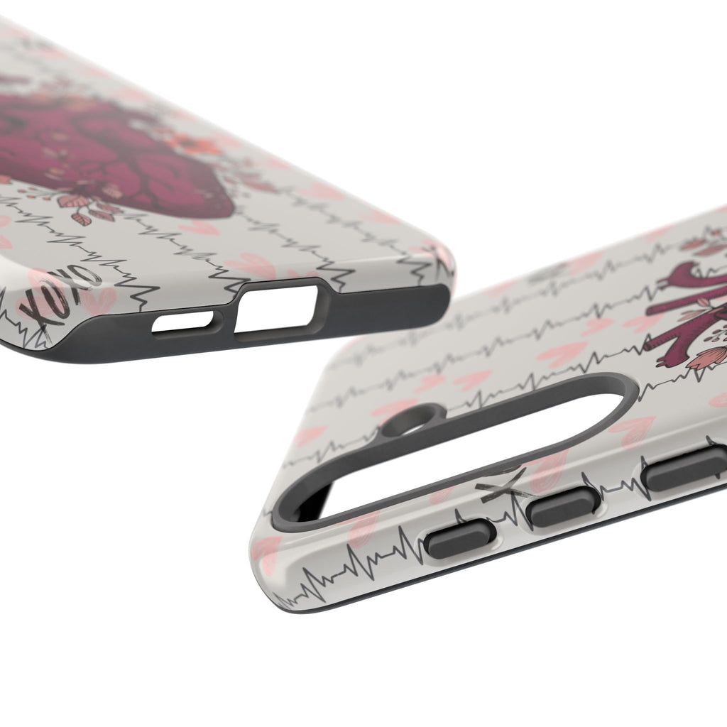 Anatomical Heart Phone Case