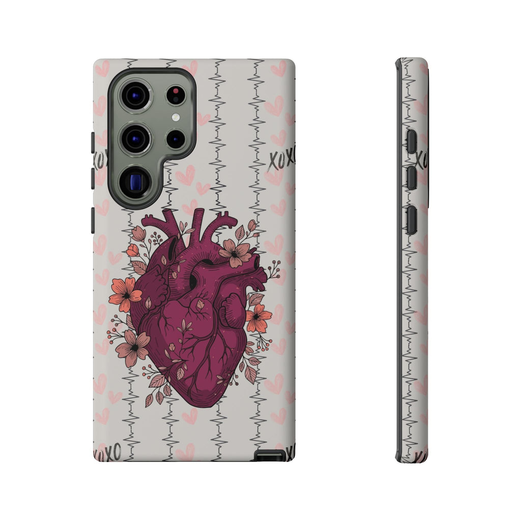 Anatomical Heart Phone Case